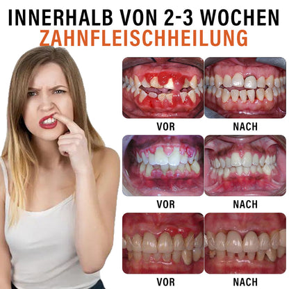 ✅Offizieller Store | Ourlyard™ Bienenwachs Antibakterieller & Anti-Warzen Mundspray 🧑🏼‍⚕️ Empfohlen von der Deutschen Gesellschaft für Zahngesundheit (DGZ)🍀